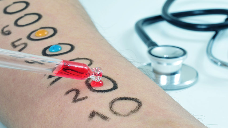 skin allergy test